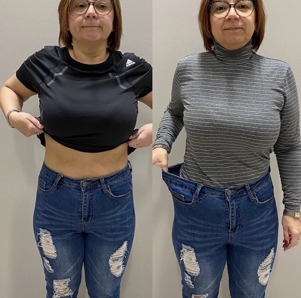 before after